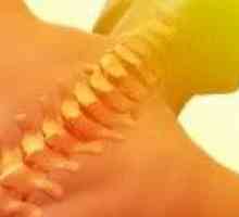 Osteocondrozei coloanei vertebrale toracice