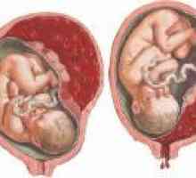 Desprinderea placentei la începutul sarcinii