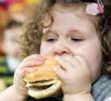 Obezitatea la copii - simptome, tratament, comentarii