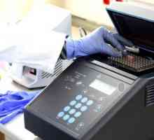 Analiza PCR: ce este?