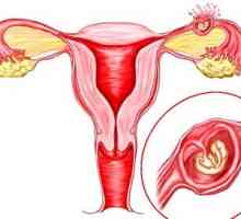 Primele semne ale unei sarcini extrauterine