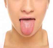 Petele de pe limba: cauze și tipuri
