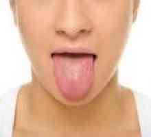 De ce limba amortit, vârful limbii? motive