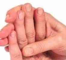 De ce degetele amorțite de mâna stângă, motivele