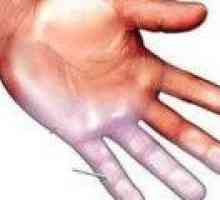 De ce degetele amorțite ale cauzelor sale de mana dreapta