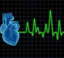 Ajutor în stare de șoc cardiogen