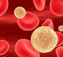 Leucocite din sânge: cauze si tratament