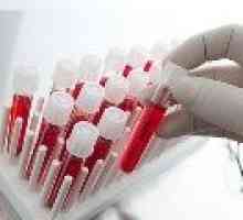 Reducerea vitezei de sedimentare a hematiilor din sânge la femei, motivele