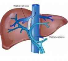 Hipertensiune portală
