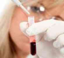 Rata ridicată de sedimentare a hematiilor în sânge, ceea ce este motivul?