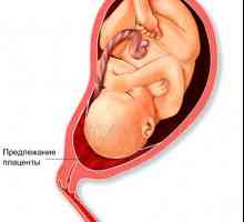 Placenta previa și localizarea placentei, care sunt