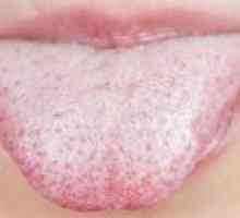 Cauzele uscăciunea gurii și a limbii de acoperire