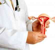 Simptomele de fibrom uterin cum sa recunoasca