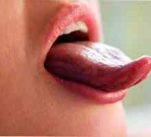 Cosurile de pe limba: cauzele si tratamentul problemei