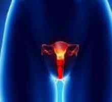 Cancer vulvar la femei - cauze, diagnostic, tratament