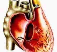 Astm cardiac