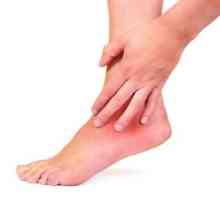 Simptomele și tratamentul artritei glezna