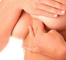 Simptomele și tratamentul mastitei la mamele care alăptează