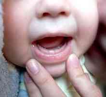 Simptomele de erupția dinților la sugari
