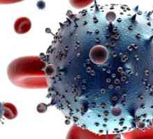 Simptomele infecției cu HIV la femei
