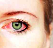 Metode de tratare a ochilor conjunctivitei