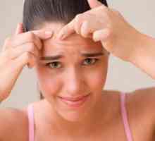 Remedii pentru acnee: Cum de a alege dreapta și eficient