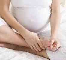Leg crampe în timpul sarcinii, cauze, tratament
