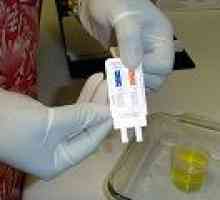Teste de droguri pentru a verifica pentru adolescenți