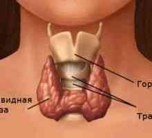 Tiroidita Hashimoto (tiroidita Hashimoto) - cauze, simptome și tratament