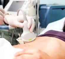 Diagnostic cu ultrasunete: pregătirea pentru studiul vezicii urinare