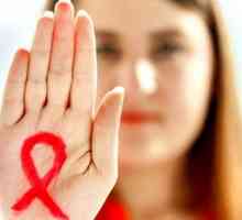 HIV la femei