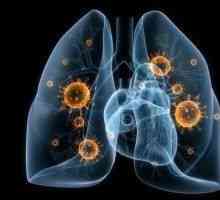 Pneumonie virala - cauze, simptome, diagnostic și tratament