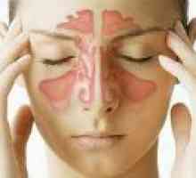 Inflamarea sinusurilor: simptome, tratament
