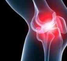 Inflamația articulației genunchiului, cauze, simptome și tratament