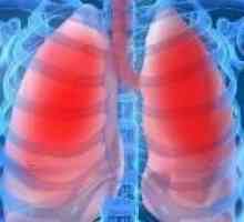 Pneumonie la adulti: simptome, tratament