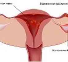 Inflamarea trompelor și ovarelor, cauze, tratament