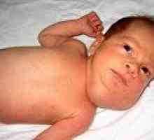 Limfangioma congenitale un copil: simptome și tratament