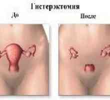 Alocarea după îndepărtarea uterului - este motivul?