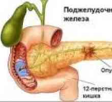 Boli ale pancreasului