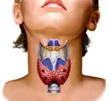 Boli tiroidiene la femei