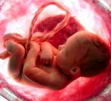Pierdute avort: semne și simptome