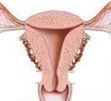 Hiperplazie endometriala glandulară - cauze, tratament
