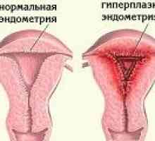 Hiperplazie endometrială Glandulocystica