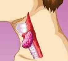 Arderea în esofag și gât, cauze, tratament