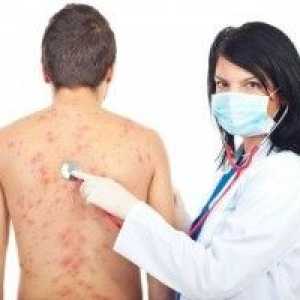 Alergic la nivelul pielii, erupții cutanate alergice