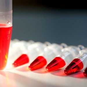 Analizele de sange pentru hormoni tiroidieni