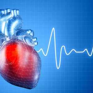 Aritmie cardiacă: simptome, tratament