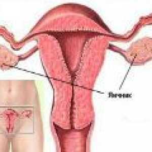 Ovarelor Sore si abdomen - ce să fac?
