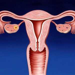 Canalul cervical: boli si tratament