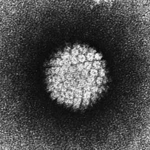 Diagnosticul și tratamentul papilomavirus pe locuri intime